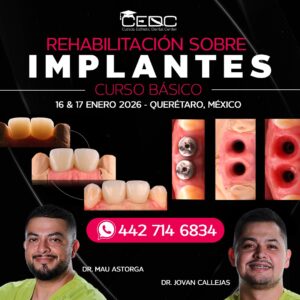 Rehabilitación sobre Implantes - 16 y 17 Enero
