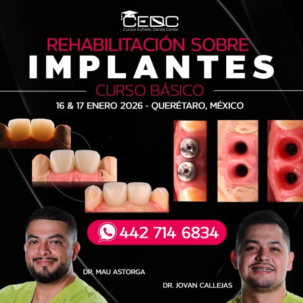 Rehabilitación sobre Implantes - 16 y 17 Enero